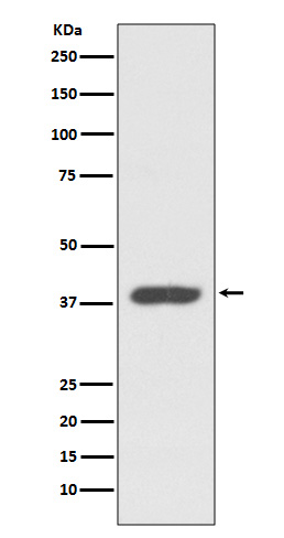 CXCR7 Rabbit mAb