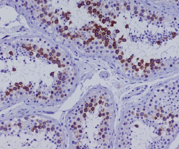 CD168 Rabbit mAb