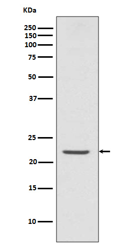 TMS1 Rabbit mAb