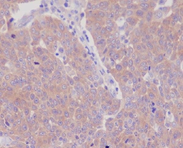 GART Rabbit mAb