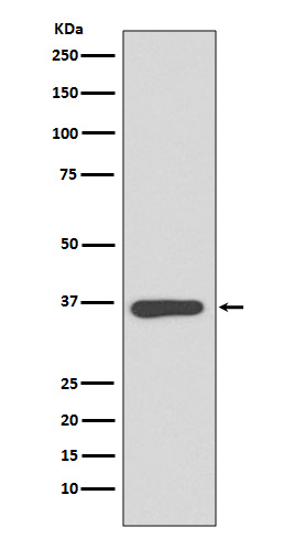 Annexin A10 Rabbit mAb