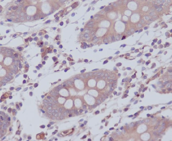 WASF2 Rabbit mAb