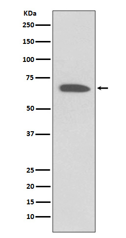 KCNA1 Rabbit mAb