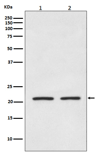 AKAP14 Rabbit mAb