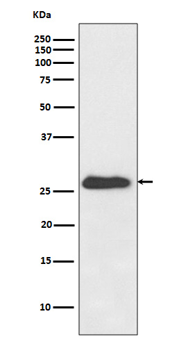 NQO2 Rabbit mAb