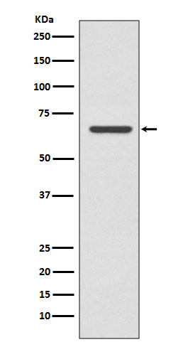 CPT2 Rabbit mAb