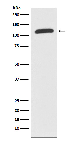 ABCF1 Rabbit mAb