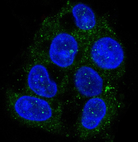 ATG9A Rabbit mAb