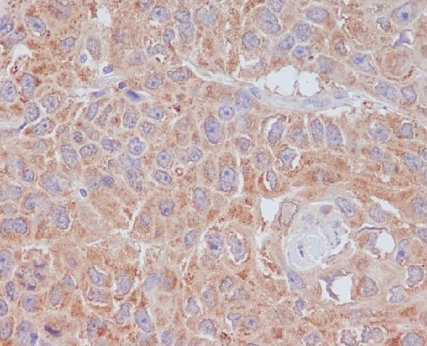 ATG9A Rabbit mAb