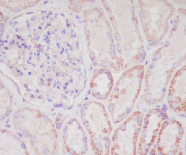 Smac/Diablo Rabbit mAb