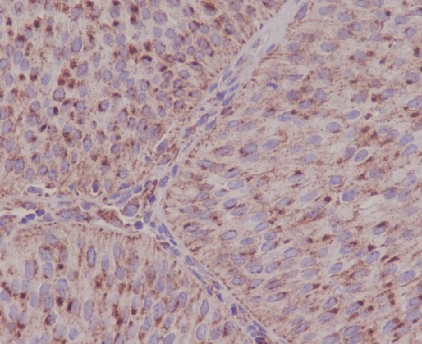 ASNS Rabbit mAb