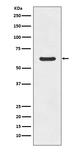 ASNS Rabbit mAb