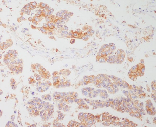 HLA-DRA Rabbit mAb