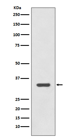 HLA-DRA Rabbit mAb