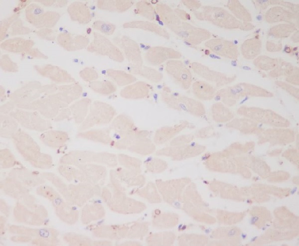 Myosin Light Chain 2 Rabbit mAb