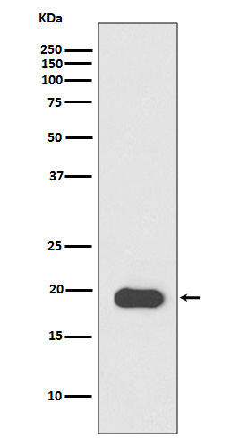 Myosin Light Chain 2 Rabbit mAb