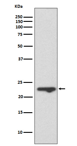 MUC1 Rabbit mAb