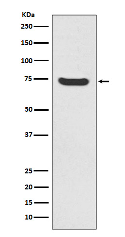 MEKK2 Rabbit mAb