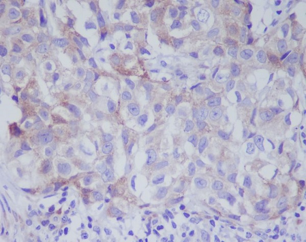 VAV2 Rabbit mAb