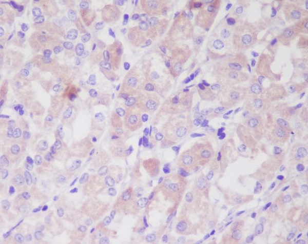 ILK Rabbit mAb