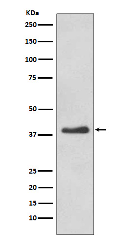 DKK1 Rabbit mAb