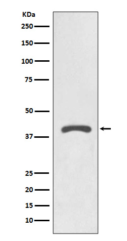 AGTR2 Rabbit mAb