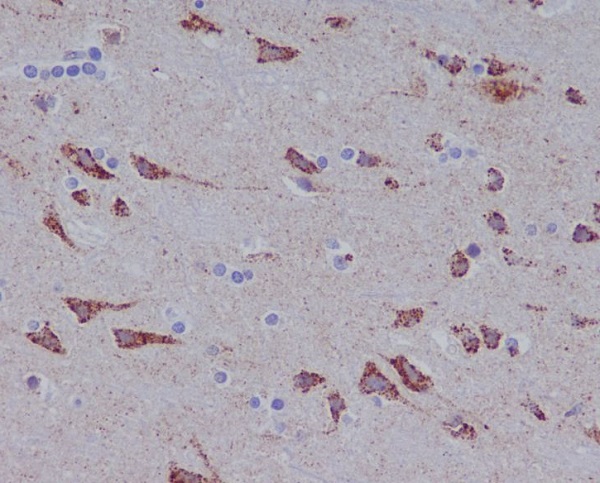 Glutaminase Rabbit mAb