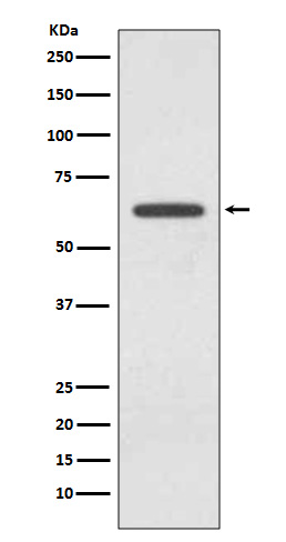 Glutaminase Rabbit mAb