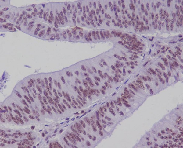 TCF7L2 Rabbit mAb