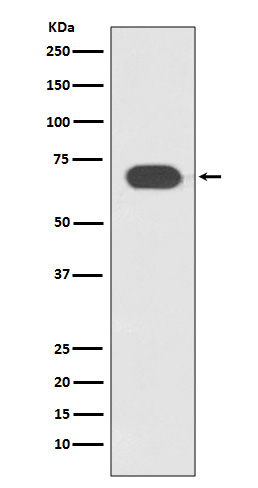 TCF7L2 Rabbit mAb