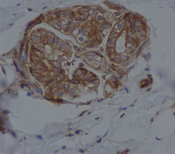 CD14 Rabbit mAb