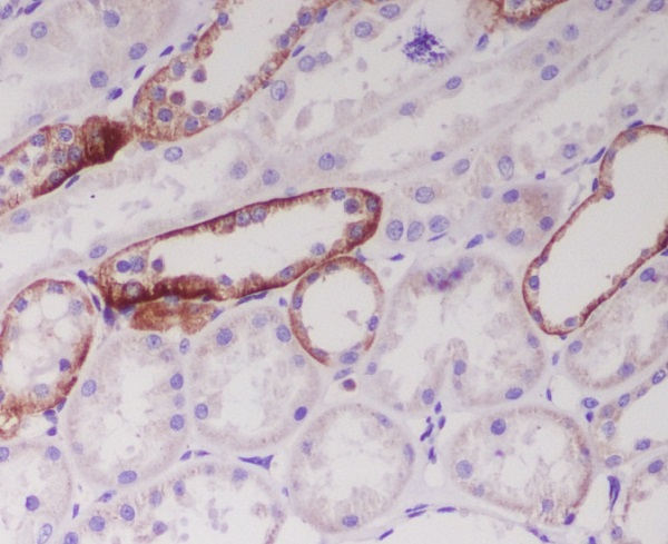 JAG1 Rabbit mAb