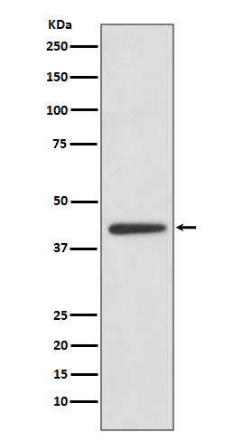 ADIPOR1 Rabbit mAb