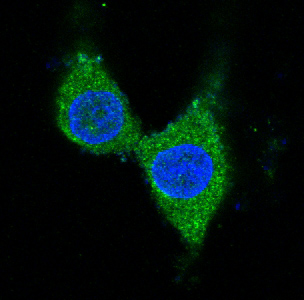 Tyrosine Hydroxylase Rabbit mAb