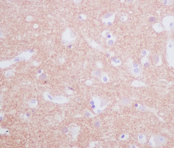 Tyrosine Hydroxylase Rabbit mAb