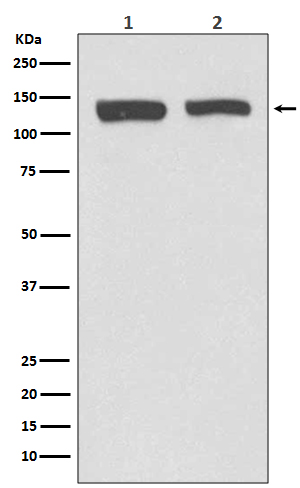 NEDD4-2 Rabbit mAb