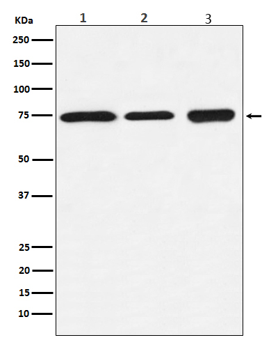 BTK Rabbit mAb