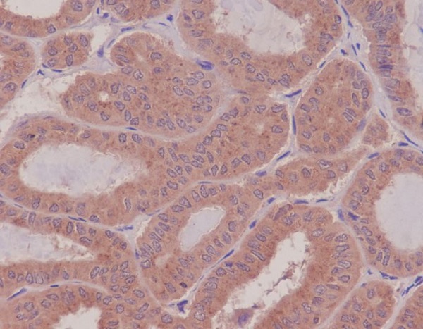 Rho Rabbit mAb