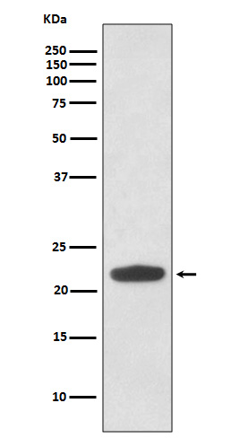 Rho Rabbit mAb