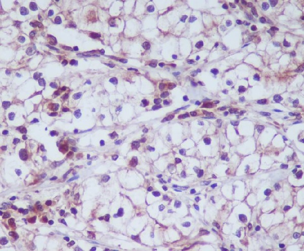 CD13 Rabbit mAb