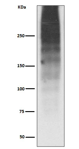 MUC16 Rabbit mAb