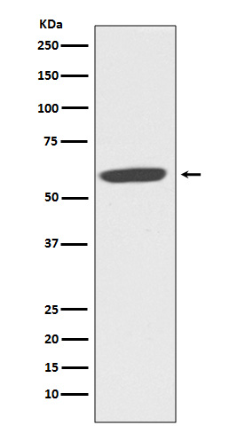 NOX2/CYBB/gp91phox Rabbit mAb