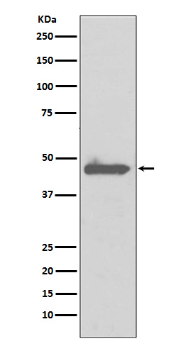 Caspase 5 Rabbit mAb