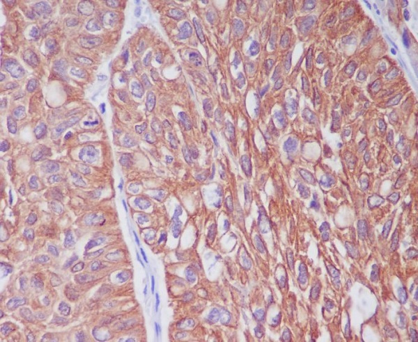 Cytokeratin 6 Rabbit mAb