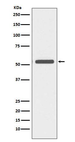 Cytokeratin 6 Rabbit mAb