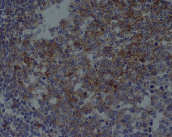 CD81 Rabbit mAb