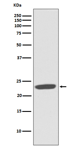 CD81 Rabbit mAb