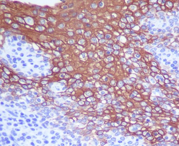 Cytokeratin 13 Rabbit mAb