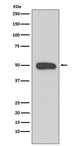 Cytokeratin 13 Rabbit mAb