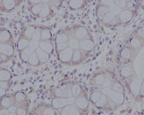 pro Caspase 3 Rabbit mAb